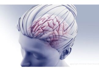 Coronary heart disease before age 45 may increase risk of dementia later in life Coronary heart disease before age 45 may increase risk of dementia later in life