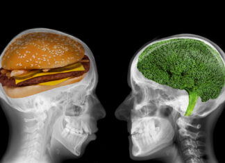 New research shows “profound” link between dietary choices and brain health New research shows “profound” link between dietary choices and brain health