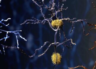 Brain Autopsies Reveal a Potential New Culprit Behind Alzheimer’s Disease : ScienceAlert Brain Autopsies Reveal a Potential New Culprit Behind Alzheimer's Disease : ScienceAlert