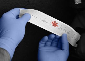 Are US cases on the rise, and if so, why? Are US cases on the rise, and if so, why?