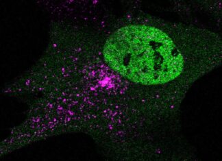 Double-Edged STING: Pitt Study Identifies New Pathway Involved in Aging Are You a Rapid Ager? Biological Age is a Better Health Indicator Than the Number of Years You’ve Lived, but it’s Tricky to Measure