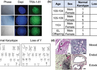 Researchers establish largest stem cell repository focused on centenarians Researchers establish largest stem cell repository focused on centenarians
