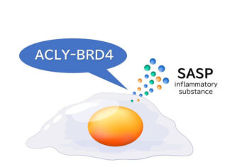 Cellular senescence research identifies key enzyme to promote healthy aging Cellular senescence research identifies key enzyme to promote healthy aging