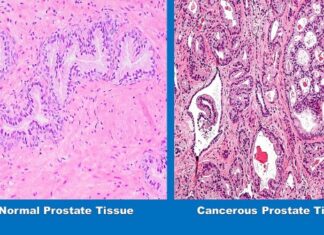 Study Suggests a Healthy Diet May Help Keep Low Gr Study Suggests a Healthy Diet May Help Keep Low Gr