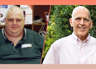 Man Loses 300 Pounds Counting Calories, No-Sugar Diet and Walking Man Loses 300 Pounds Counting Calories, No-Sugar Diet and Walking