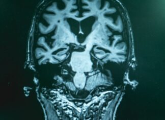 Cognition, Physical Performance, and Brain Health at Age 70 Cognition, Physical Performance, and Brain Health at Age 70