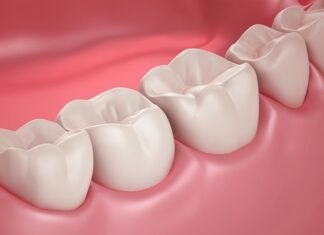 Atom probe tomography reveals fluoride patterns in aging teeth Atom probe tomography reveals fluoride patterns in aging teeth
