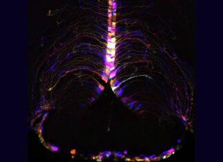 Map is first step toward healthy brains into old age Map is first step toward healthy brains into old age