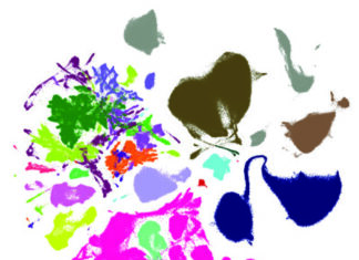 Aging may change some brain cells more than others Aging may change some brain cells more than others