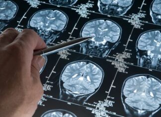 Brain Cells Linked to Aging Identified Brain Cells Linked to Aging Identified