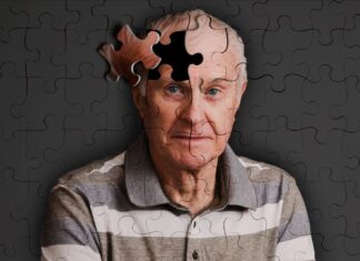 AI Model Measures Pace of Brain Aging, Could Aid Prediction of Cognitive Decline Alzheimer's Disease