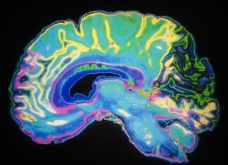 Senolytics offer hope for more precise Alzheimer’s treatments New AI tool measures brain aging speed and predicts cognitive health