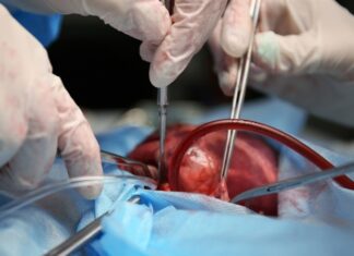 Older adults and women more likely to develop postoperative infections after heart surgery Older adults and women more likely to develop postoperative infections after heart surgery
