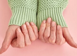 The unexpected aging clues hidden in your nails, according to 3 dermatologists The unexpected aging clues hidden in your nails, according to 3 dermatologists