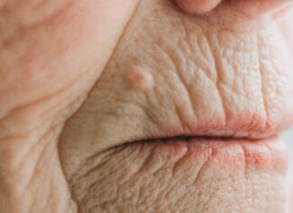 Analysis: Potential and limitations of NMN for slowing down aging Analysis: Potential and limitations of NMN for slowing down aging