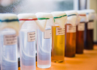 Do you want to help find a cure for cancer? Donate your data and biospecimens Set of Laboratory Glassware with liquids