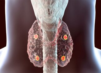 Heart Health Worsened in Pts With Chronic Hypoparathyroidism Heart Health Worsened in Pts With Chronic Hypoparathyroidism