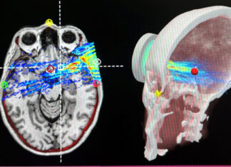 Kimera® Labs Named Semifinalist in $101 Million XPRIZE Healthspan Competition for Pioneering Innovations in Healthy Aging Kimera® Labs Named Semifinalist in $101 Million XPRIZE Healthspan Competition for Pioneering Innovations in Healthy Aging