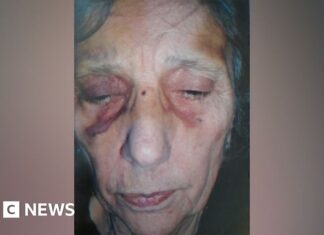 Lampard Inquiry deeply worried about elderly mental healthcare Lampard Inquiry deeply worried about elderly mental healthcare