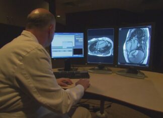 Heart conditions on the rise among younger adults Heart conditions on the rise among younger adults