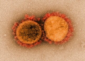 Link Between Mental Health and Long COVID in Older Women Link Between Mental Health and Long COVID in Older Women