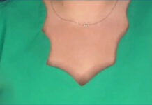 MercyOne Aledo, Dewitt announce program for senior mental health MercyOne Aledo, Dewitt announce program for senior mental health