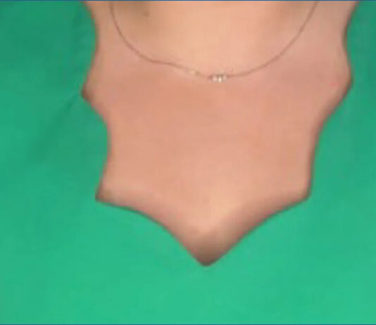 MercyOne Aledo, Dewitt announce program for senior mental health MercyOne Aledo, Dewitt announce program for senior mental health